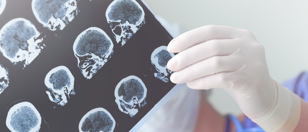 Auxilio Centro de Neurodiagnóstico