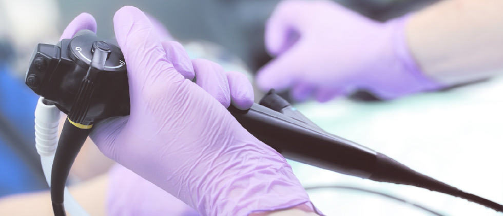 Endoscopía